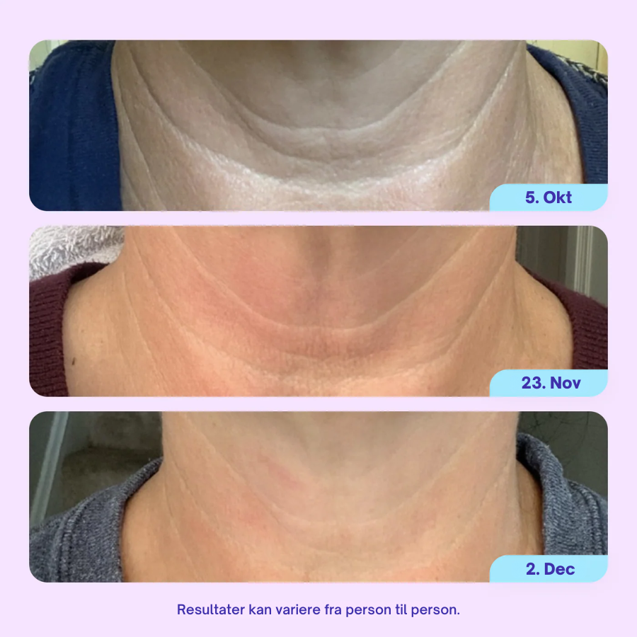 Firm & Lift Neck Cream - Avanceret opstrammende og løftende formel - Anti-aging hudpleje til halsen