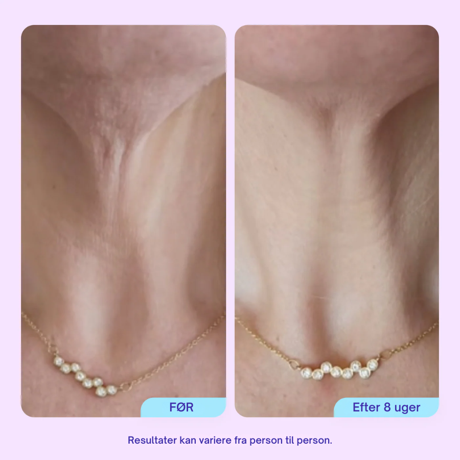 Firm & Lift Neck Cream - Avanceret opstrammende og løftende formel - Anti-aging hudpleje til halsen