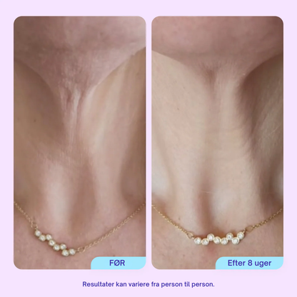 Firm & Lift Neck Cream - Avanceret opstrammende og løftende formel - Anti-aging hudpleje til halsen