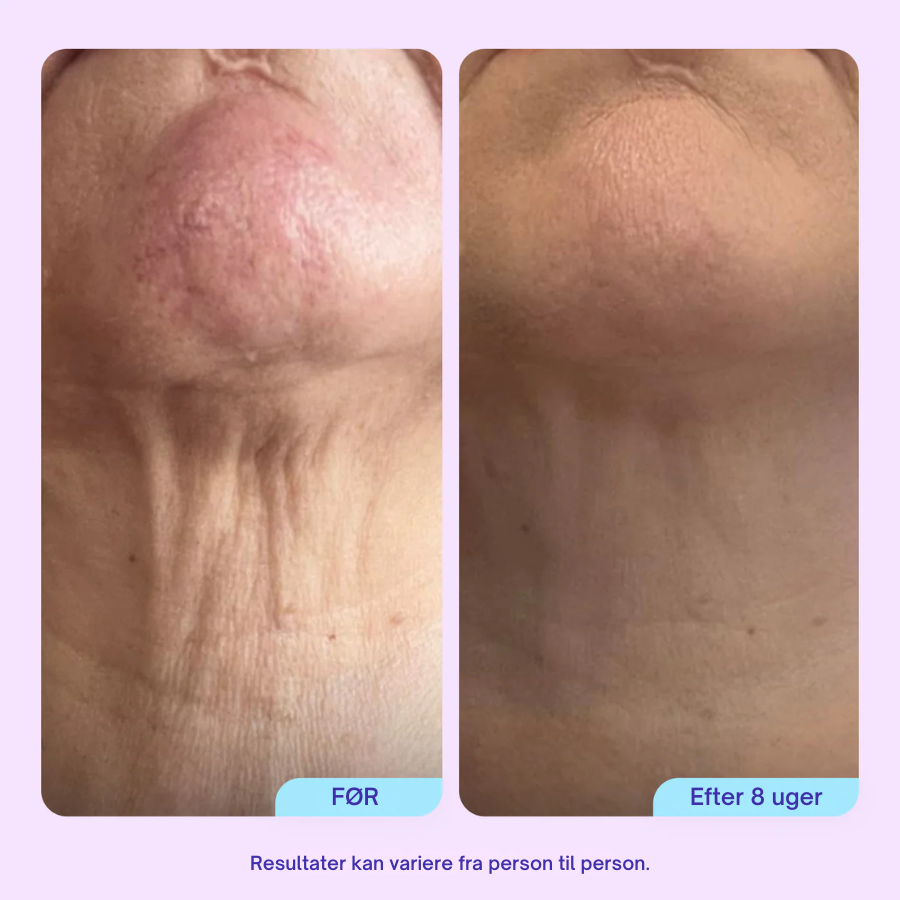 Firm & Lift Neck Cream - Avanceret opstrammende og løftende formel - Anti-aging hudpleje til halsen