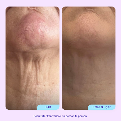 Firm & Lift Neck Cream - Avanceret opstrammende og løftende formel - Anti-aging hudpleje til halsen