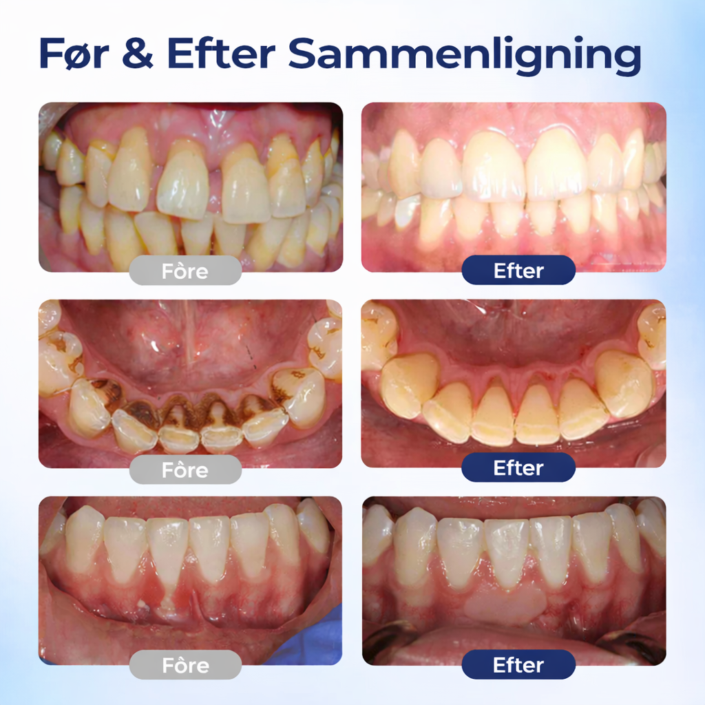 VitalDental Repair - Mundskyl til bekæmpelse af plak, heling af tandkød og tandblegning