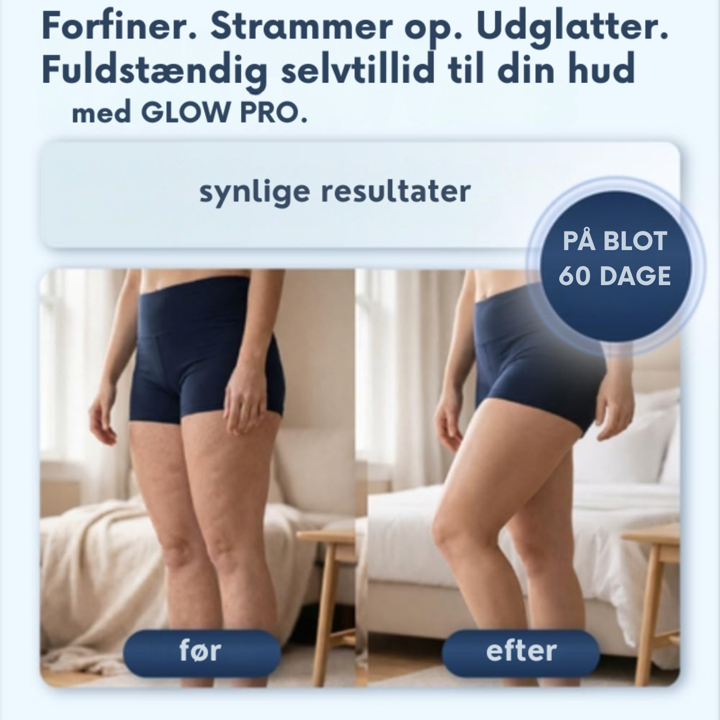 GlowPro: Mindsk cellulite, forbedr blodcirkulationen og genvind din naturlige glød.