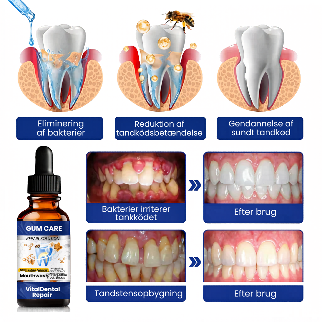 VitalDental Repair - Mundskyl til bekæmpelse af plak, heling af tandkød og tandblegning
