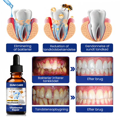 VitalDental Repair - Mundskyl til bekæmpelse af plak, heling af tandkød og tandblegning